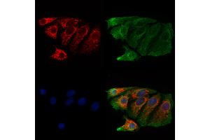 ABIN6261004 and ABIN6273214 staining Hela cells by IF/ICC. (CPLX2 抗体  (Internal Region))