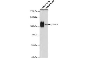 Western blot analysis of extracts of various cell lines, using MANBA antibody. (MANBA 抗体)