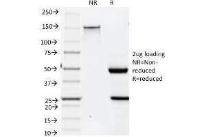 SDS-PAGE (SDS) image for anti-Keratin 19 (KRT19) antibody (ABIN6939943)