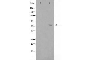 Western Blotting (WB) image for anti-Solute Carrier Family 2 (Facilitated Glucose Transporter), Member 1 (SLC2A1) (C-Term) antibody (ABIN6261995)