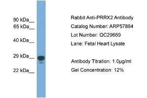 WB Suggested Anti-PRRX2  Antibody Titration: 0. (PRRX2 抗体  (Middle Region))