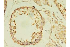 Immunohistochemistry of paraffin-embedded human testis tissue using ABIN7174932 at dilution of 1:100 (CFAP92/KIAA1257 抗体  (AA 1-297))