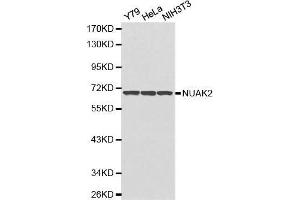 Western blot analysis of extracts of various cell lines, using NUAK2 antibody. (NUAK2 抗体  (AA 523-672))