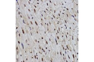 Immunohistochemistry (IHC) image for anti-Programmed Cell Death 7 (PDCD7) antibody (ABIN3022040)