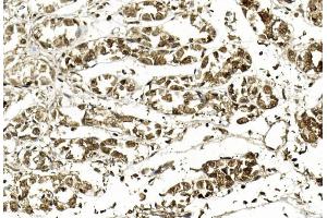 Immunohistochemical analysis of paraffin-embedded Human stomach section using Pink1 am8490b. (APEX1 抗体)