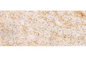 Immunohistochemistry of paraffin-embedded Human brain tissue using RHCG Polyclonal Antibody at dilution of 1:25(x200) (RHCG 抗体)