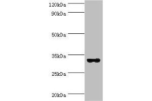 Western blot All lanes: STX11 antibody at 6 μg/mL + Mouse skeletal muscle tissue Secondary Goat polyclonal to rabbit IgG at 1/10000 dilution Predicted band size: 33 kDa Observed band size: 33 kDa (Syntaxin 11 抗体  (AA 1-287))