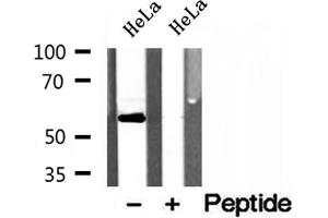 Western blot analysis of extracts of HeLa cells, using PDLIM7 antibody. (PDLIM7 抗体  (N-Term))