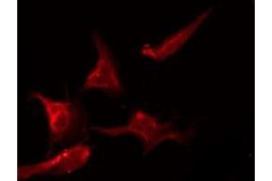 Immunofluorescence (fixed cells) (IF/ICC) image for anti-Sodium Channel, Voltage-Gated, Type II, beta (SCN2B) (Internal Region) antibody (ABIN6258329)