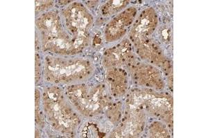 Immunohistochemical staining of human kidney with ZNF234 polyclonal antibody  shows distinct nuclear and moderate cytoplasmic positivity in cells in tubules at 1:50-1:200 dilution. (ZNF234 抗体)