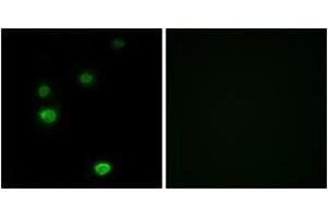 Immunofluorescence analysis of LOVO cells, using RPC5 Antibody. (POLR3E 抗体  (AA 191-240))