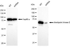 Western blotting analysis using checkpoint kinase 2 antibody (ABIN7798040). (Recombinant CHEK2 抗体)