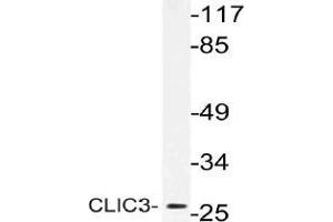 Western blot (WB) analysis of CLIC3 antibody in extracts from MCF-7 cells. (CLIC3 抗体)