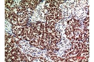 Immunohistochemistry (IHC) image for anti-Alkaline Ceramidase 2 (ACER2) (Internal Region) antibody (ABIN7185929)