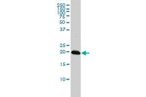 C22orf18 monoclonal antibody (M01), clone 4C12-2C8 Western Blot analysis of C22orf18 expression in K-562 . (CENPM 抗体  (AA 1-180))