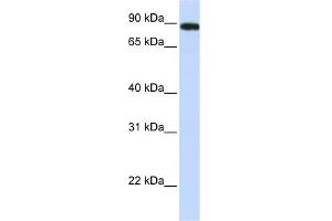WB Suggested Anti-FAM47A Antibody Titration: 0. (FAM47A 抗体  (Middle Region))