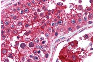 Human Testis (formalin-fixed, paraffin-embedded) stained with mTOR antibody ABIN214561 at 2. (MTOR 抗体  (AA 2440-2457))