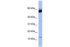 S100A9 antibody used at 1 ug/ml to detect target protein.