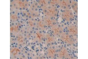 Immunohistochemistry (IHC) image for anti-ATP-Binding Cassette, Sub-Family B (MDR/TAP), Member 7 (ABCB7) (AA 472-752) antibody (ABIN5013185)