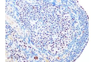 Immunohistochemistry of paraffin-embedded rat ovary using SUMO2/3 Rabbit mAb (ABIN7270370) at dilution of 1:100 (40x lens). (SUMO2 抗体)