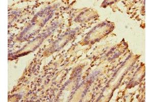 Immunohistochemistry of paraffin-embedded human duodenal tissue using ABIN7152685 at dilution of 1:100 (FRMD6 抗体  (AA 413-622))