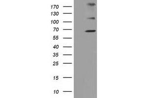 Western Blotting (WB) image for anti-Zinc Finger, Imprinted 2 (ZIM2) (AA 1-150), (AA 428-527) antibody (ABIN1490588) (ZIM2 抗体  (AA 1-150, AA 428-527))