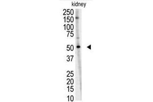 Image no. 1 for anti-Ring Finger Protein 216 (RNF216) (C-Term) antibody (ABIN357474) (RNF216 抗体  (C-Term))