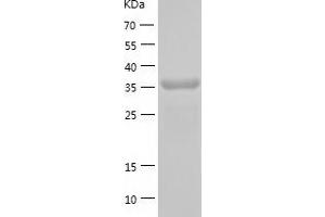Western Blotting (WB) image for Dihydroorotate Dehydrogenase (DHODH) (AA 31-395) protein (His tag) (ABIN7122667)