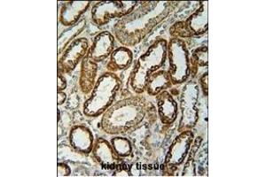 Immunohistochemistry (Paraffin-embedded Sections) (IHC (p)) image for anti-NADH Dehydrogenase (Ubiquinone) 1, Subcomplex Unknown, 2, 14.5kDa (NDUFC2) (AA 90-119), (C-Term) antibody (ABIN654699)