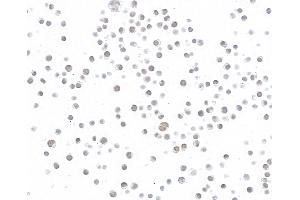 Immunocytochemistry (ICC) image for anti-Bloom Syndrome RecQ Like Helicase (BLM) (C-Term) antibody (ABIN7795726) (Recombinant BLM 抗体  (C-Term))