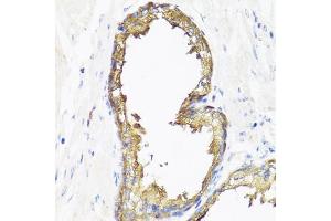 Immunohistochemistry of paraffin-embedded human prostate using SMAD2 antibody (ABIN5998884) at dilution of 1/100 (40x lens). (SMAD2 抗体)