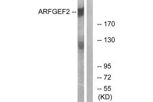 Western blot analysis of extracts from A549 cells, using ARFGEF2 antibody. (ARFGEF2 抗体  (C-Term))