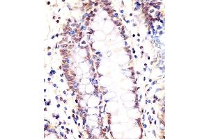(ABIN6243725 and ABIN6578368) staining LSM2 in human colon tissue sections by Immunohistochemistry (IHC-P - paraformaldehyde-fixed, paraffin-embedded sections). (LSM2 抗体  (AA 55-89))
