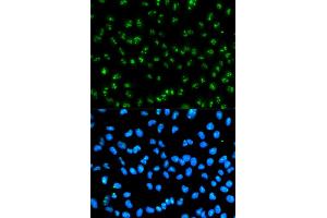Immunofluorescence analysis of HeLa cells using FBL antibody. (Fibrillarin 抗体)