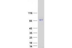 Validation with Western Blot
