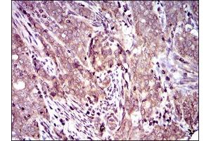 Immunohistochemistry (IHC) image for anti-Dynactin 4 (DCTN4) (AA 57-298) antibody (ABIN1724791)