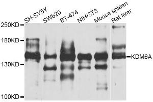 Western blot analysis of extracts of various cell lines, using KDM6A antibody (ABIN5974652) at 1/1000 dilution. (KDM6A 抗体)