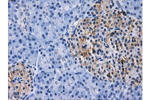 Immunohistochemical staining of paraffin-embedded liver tissue using anti-RPA2 mouse monoclonal antibody. (RPA2 抗体)