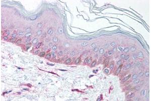 Human Skin (formalin-fixed, paraffin-embedded) stained with EEA1 antibody ABIN214099 at 5 ug/ml followed by biotinylated goat anti-rabbit IgG secondary antibody ABIN481713, alkaline phosphatase-streptavidin and chromogen. (EEA1 抗体  (AA 307-356))