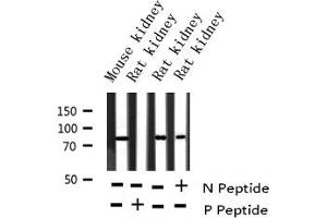 Western Blotting (WB) image for anti-Adducin 1 (Alpha) (ADD1) (pSer726) antibody (ABIN6255485)