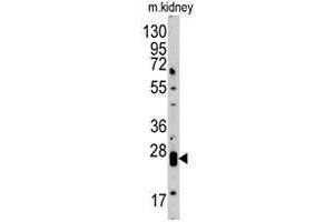 Western blot analysis of CLDN1 polyclonal antibody  in mouse kidney tissue lysate (35 ug/lane). (Claudin 1 抗体)