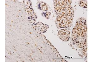 Immunoperoxidase of monoclonal antibody to TESK2 on formalin-fixed paraffin-embedded human placenta.