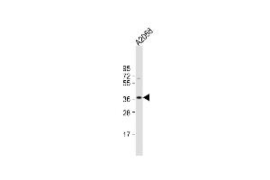 Anti-IgA Antibody (C-term) at 1:1000 dilution +  whole cell lysate Lysates/proteins at 20 μg per lane.