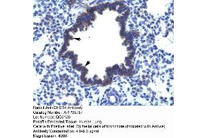 Human Lung (CHST4 抗体  (Middle Region))