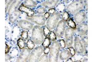 CASR was detected in paraffin-embedded sections of rat kidney tissues using rabbit anti- CASR Antigen Affinity purified polyclonal antibody (Catalog # ) at 1 µg/mL. (CASR 抗体  (AA 926-1078))