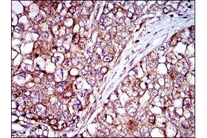 Immunohistochemistry (IHC) image for anti-Zinc Finger Protein 42 (ZFP42) (AA 249-310) antibody (ABIN1846770) (ZFP42 抗体  (AA 249-310))
