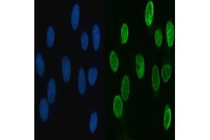 IF analysis of HNRNPL using anti-HNRNPL antibody (ABIN4886624).