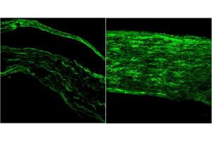 ABIN5539690 (1µg/ml) staining of PFA-perfused cryosection of Mouse sciatic nerve (left) and injured sciatic nerve (right). (BDNF 抗体  (Internal Region))
