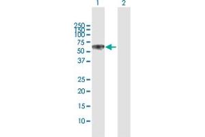 Western Blot analysis of DPYSL5 expression in transfected 293T cell line by DPYSL5 MaxPab polyclonal antibody.