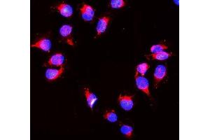 IF analysis of Peroxiredoxin 1 using anti- Peroxiredoxin 1 antibody (ABIN3043903). (Peroxiredoxin 1 抗体  (Middle Region))